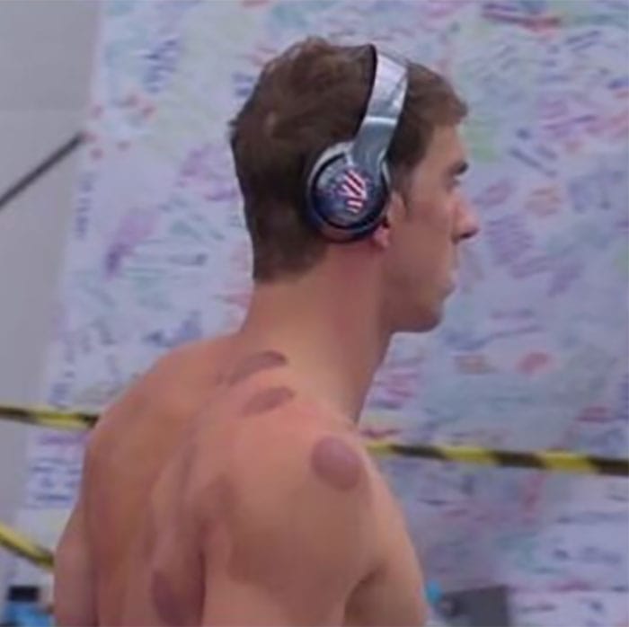 Ever Wonder Why Olympians Are Covered In Large Red Circles?