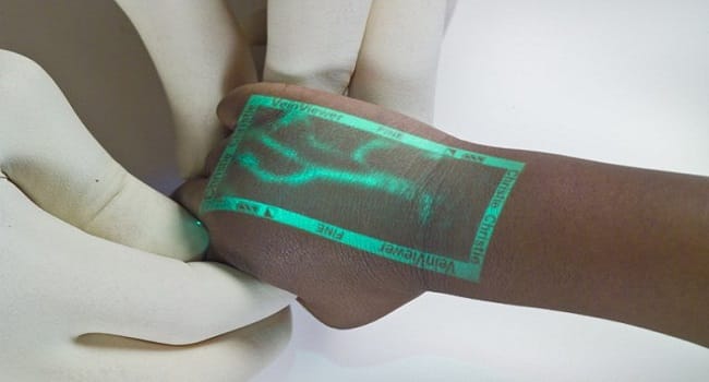 Ask Your Doctors To Use Vein Viewer To Find The Veins Easily.