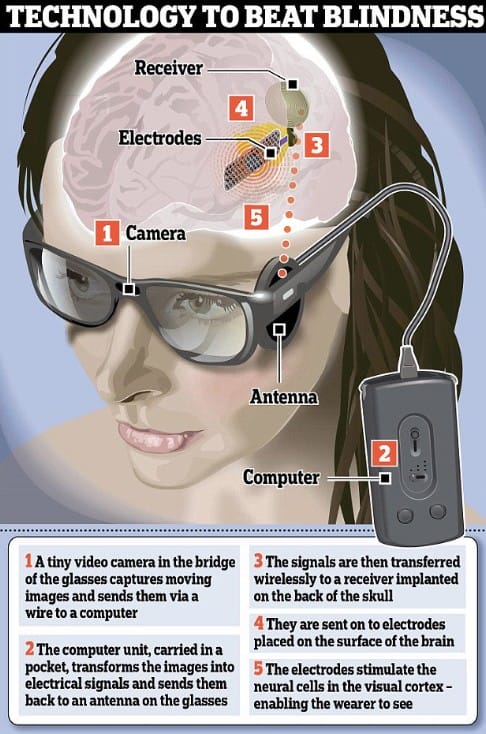 Scientist Have Succeeded In Getting Your Vision Back By This New Bionic Eye Implant.