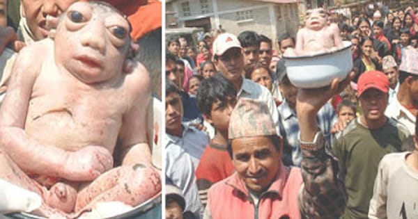 10 Bizzare Births In Which Animals Were Born From Humans
