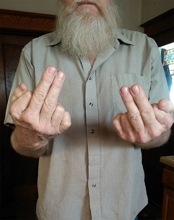 12 People Whose Genetics Made Them Super Unique
