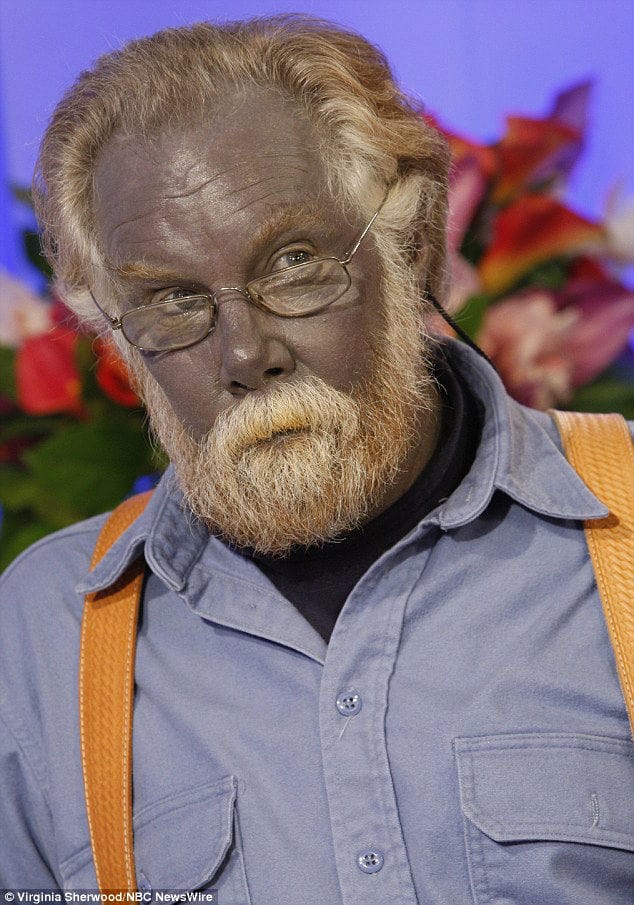 15 Bizarre Medical Conditions That Sound Too Insane To Be True