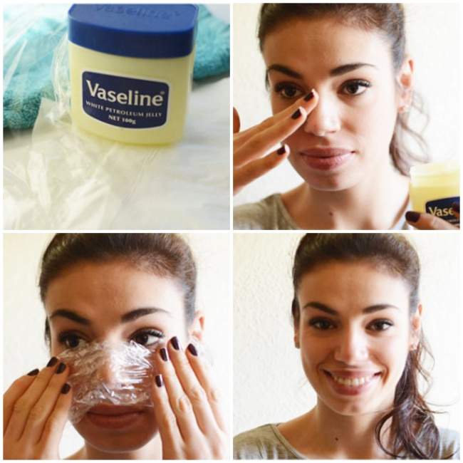 8 Natural Ways To Get Rid Of Blackheads And Whiteheads Fast