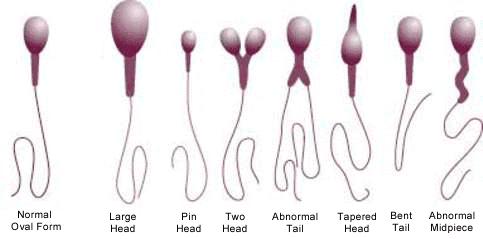 85-Year-Old Man Had To Take A Sperm Count For His Physical. The Result Is Shocking.