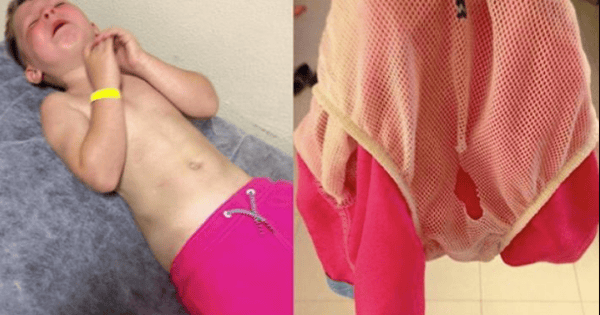 Check How A Simple Swimming Short Turned Out To Become The Worst Nightmare For A 5 Year Old.