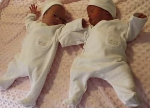 Couple Was Expecting Identical Twins, They Were Stunned When Doctor Said Sorry!