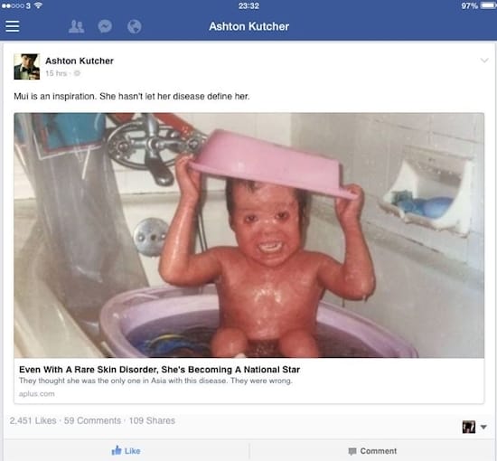 Doctors Hid This Baby So Nobody Could See This Face. 22 Years Later, She Shows It All