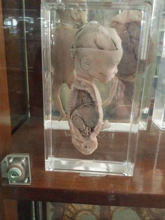 Horrifying Things At Museum Of Thailand Will Send Shivers Down Your Spine