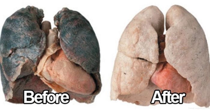How To Purify Your Lungs Within 72 Hours!