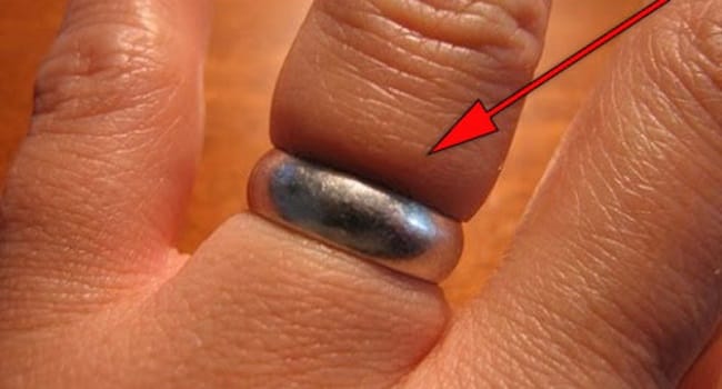 If You Have A Ring Stuck On Your Finger, Here's How To Remove It With Ease