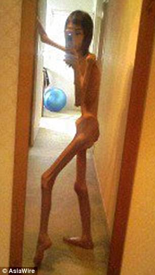Japanese Woman Shares Shocking Selfies From When She Weighed 37 lbs