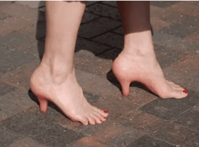 11 Pictures That Will Disgust You And Keep You Up At Night