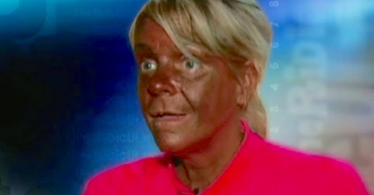 She Hogged The Limelight For A Crisp Tan! 4 Years Later She Looks Like This