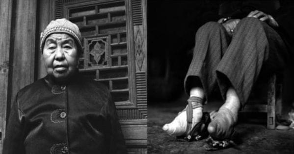 She Is The Only One Left Who Is Following A 1000 Year Old Chinese Tradition Of Foot-Binding. Look At her...
