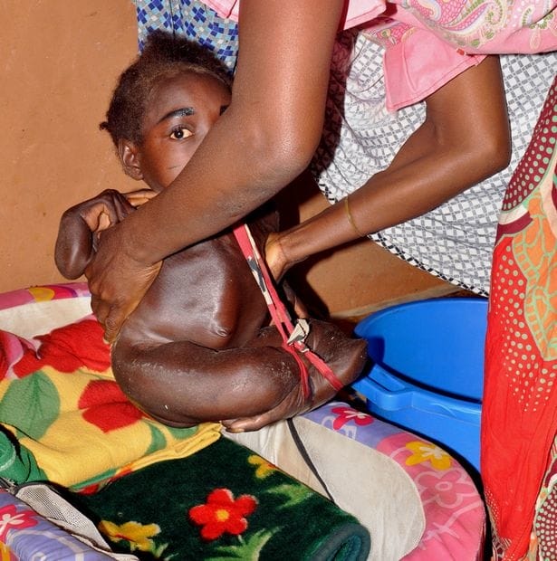 She Spent Her Life In A Plastic Bowl, But The Reason Is Heartbreaking..