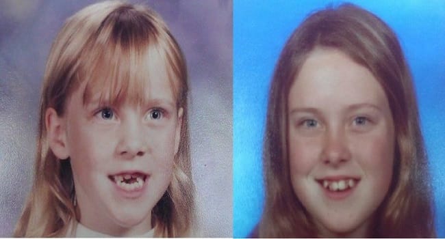 She gets Called A 'Monster' For Her Entire Life Due To Her Looks, She's Now Having The Last Laugh