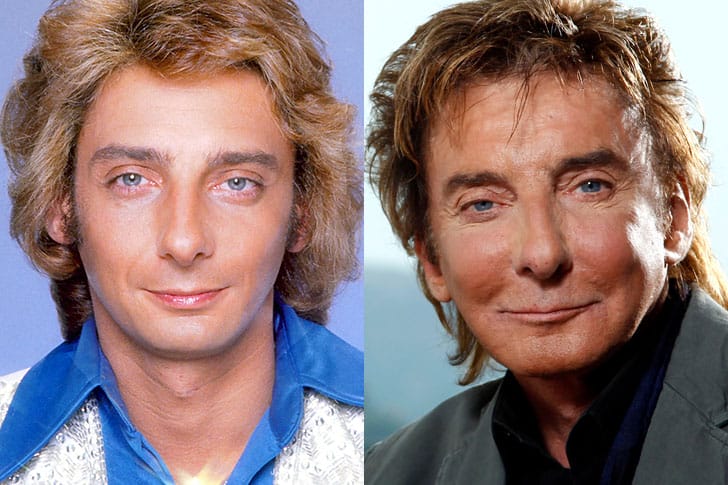 The 17 Most Astonishing Celebrity Plastic Surgery Disasters Of All Time!