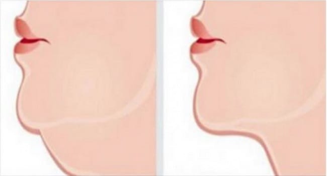 The Most Effective Exercises To Get Rid Of That UNSIGHTLY Double Chin