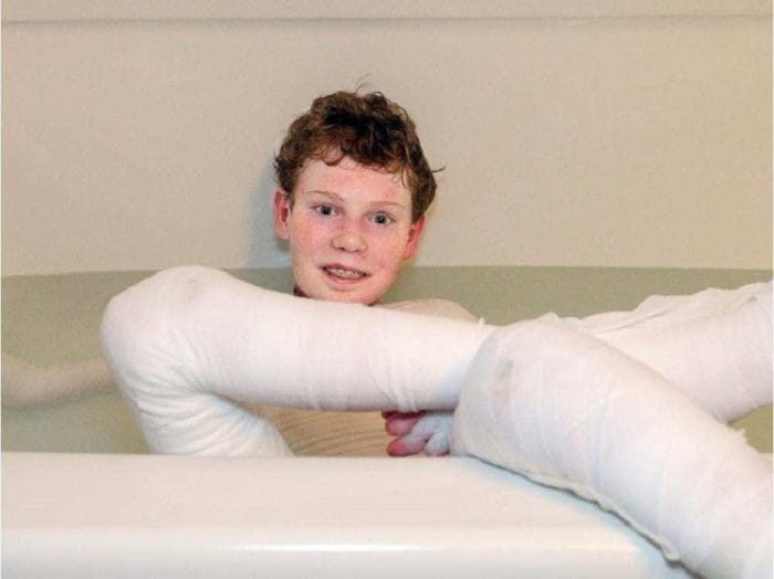 The Story Of The Little Boy Whose Skin Falls Even At The Slight Touch Is Really Painful