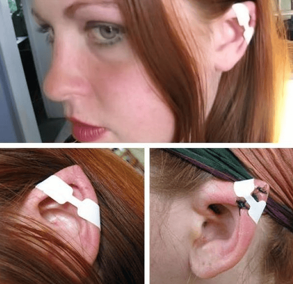 These 7 People Opted For Some Unusual Body Modification That'll Surely Make You Uneasy.