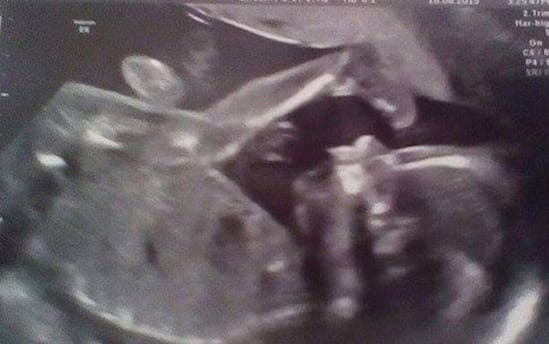 This Mom BEGS The Nurse To Say What's Wrong With The Baby. Then She Sees The SHOCKING...
