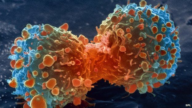 This Root Kills 98% Of Cancer Cells In Practically No Time