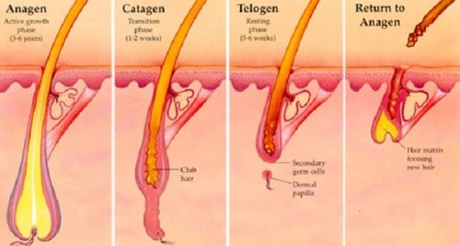 Use This Easy To Do Home Remedy To Remove Ingrown Hair