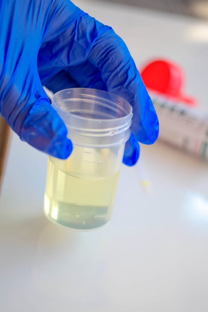 What The Color Of Your Urine Says About Your Health?